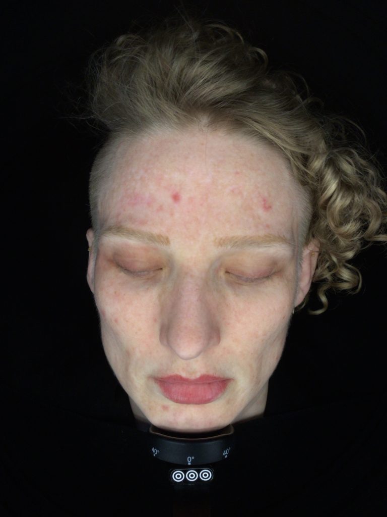 Skin scanning assessment oasis wellbeing clinic